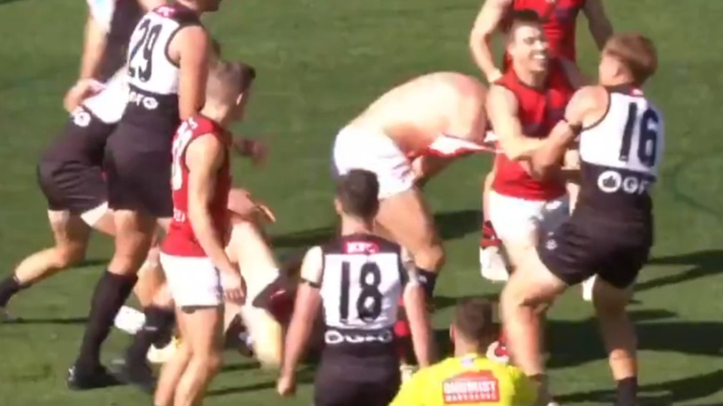 Bomber's jumper torn in Fantasia scuffle