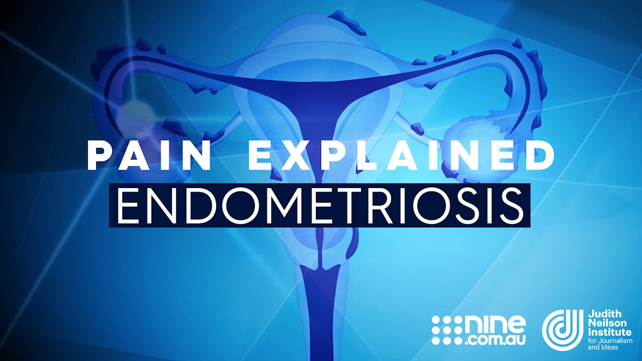 Pain Explained: Endometriosis