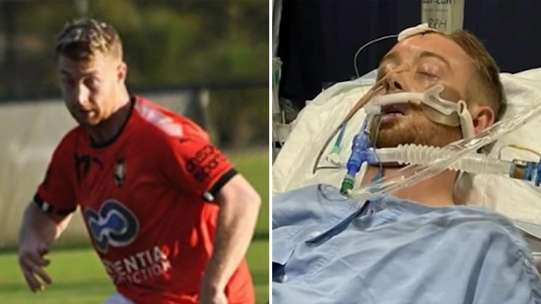 Footballer Danny Hodgson awakes from coma