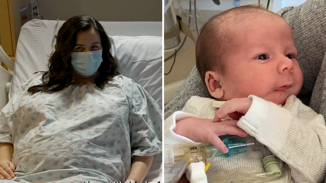 Doctors in the US save newborn child's life by operating on him mid birth