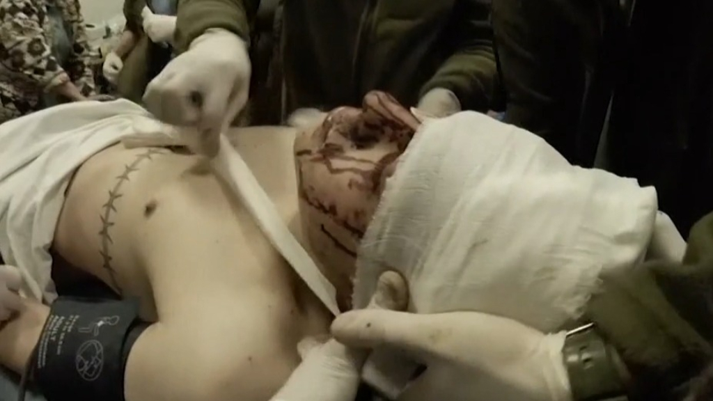 Ukrainian medic shows horrors of Mariupol invasion