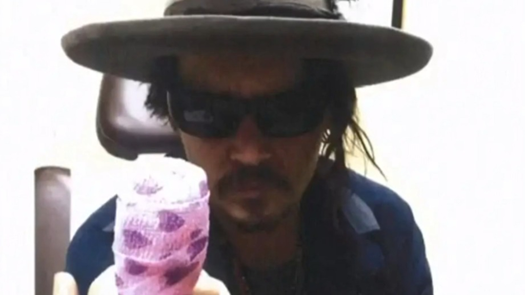 Expert witness challenges how Johnny Depp severed his finger