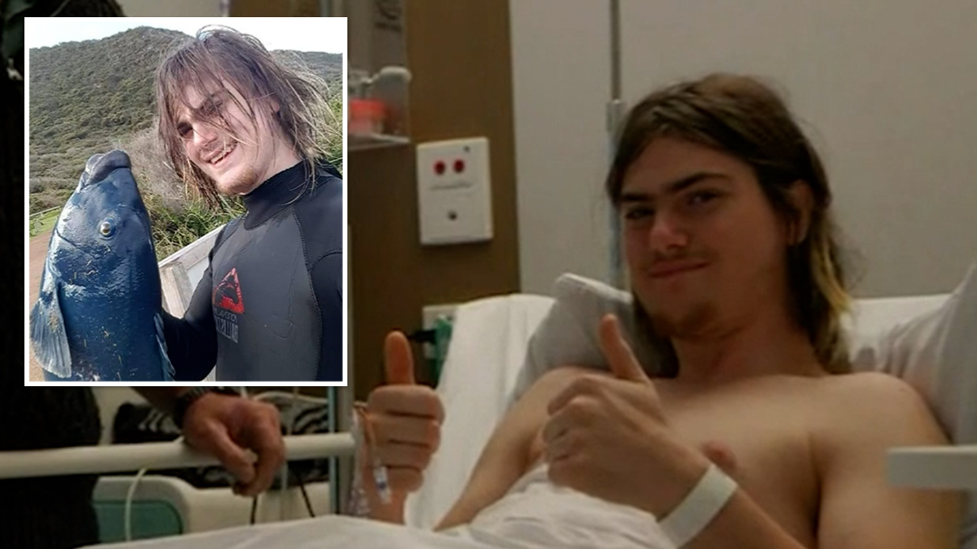 Teen survives great white shark attack