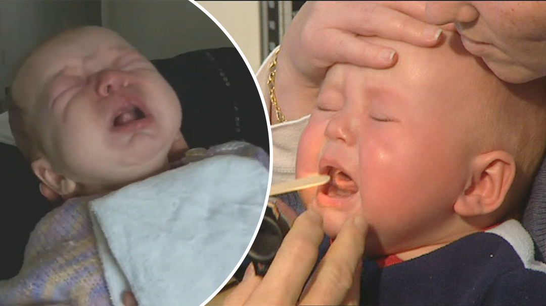 Health warning issued as whooping cough cases rise in Queensland