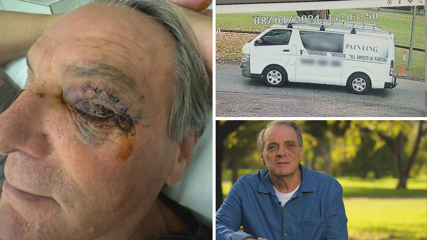 Grandfather who was allegedly coward punched feared for his life