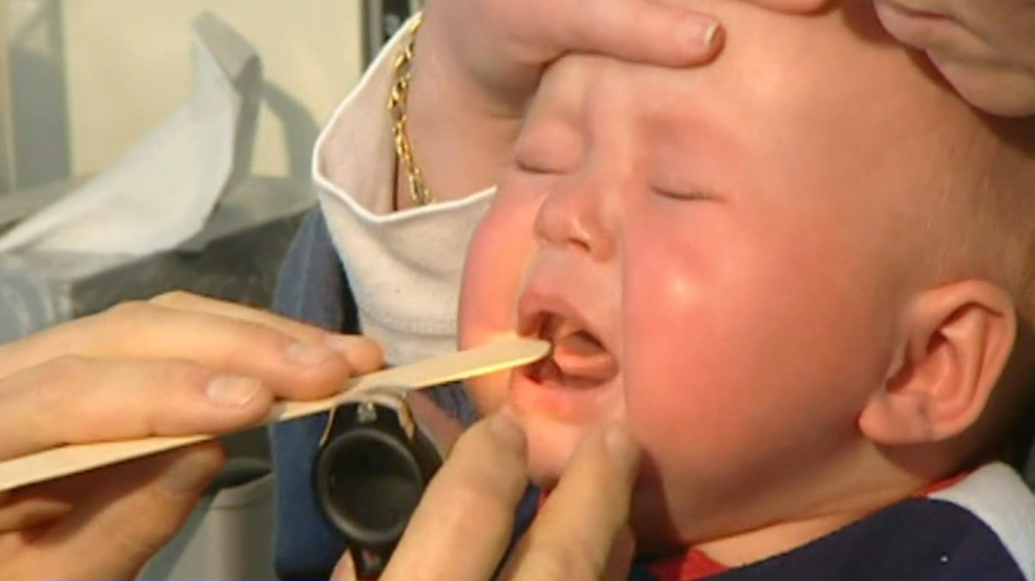 Cases of whooping cough spike in South Australia