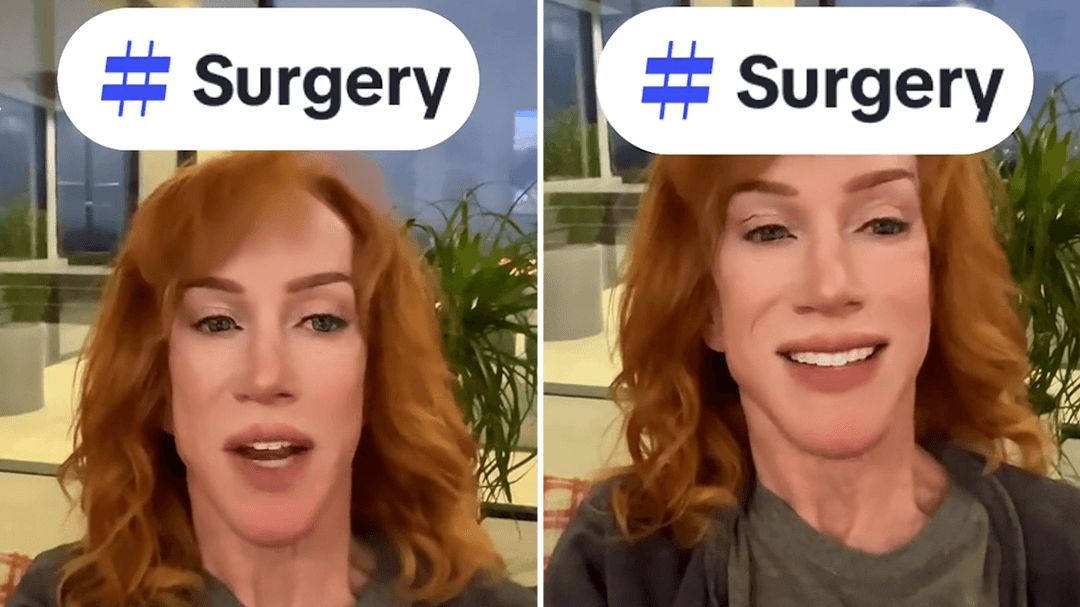 Kathy Griffin reveals she needs to have vocal surgery