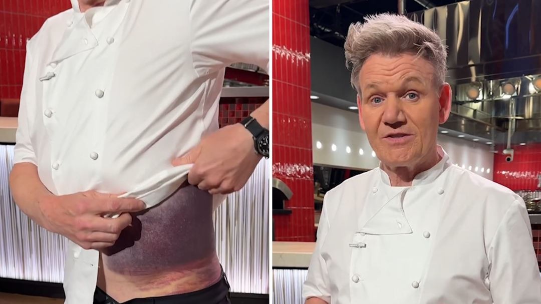 Gordon Ramsay says he's lucky to be alive after bike accident